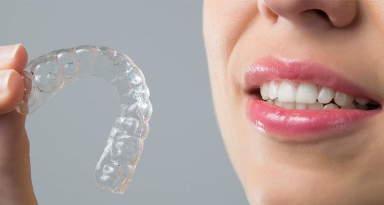 aligner co invisible teeth aligners